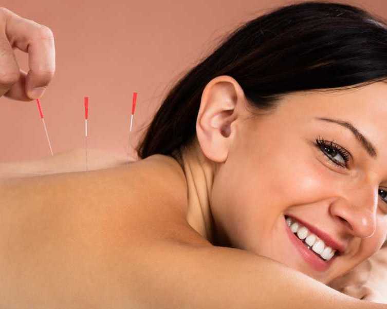 chinese-medicine-acupuncture-for-pain-relief-wellness