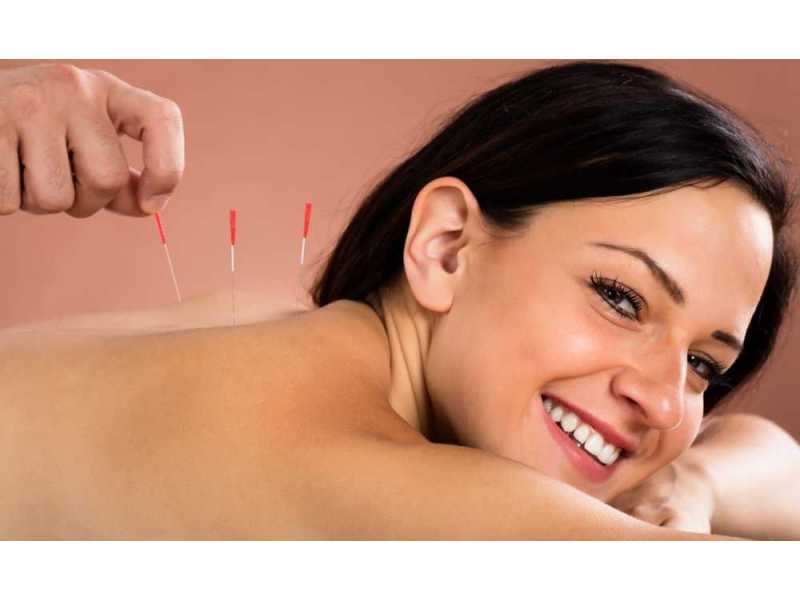 chinese-medicine-acupuncture-for-pain-relief-wellness-small-0