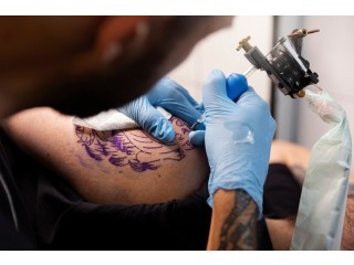 Choose The Best Laser Tattoo Removal Course