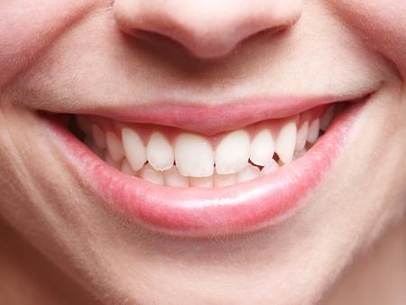 teeth-gaps-causes-treatments-explained-by-vistasol-dental