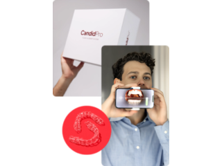 clear-aligners-for-a-confident-natural-smile-in-denver-co-small-0
