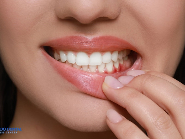 advanced-gum-disease-treatment-for-healthier-gums-big-0