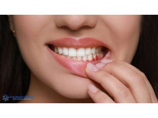 advanced-gum-disease-treatment-for-healthier-gums-small-0