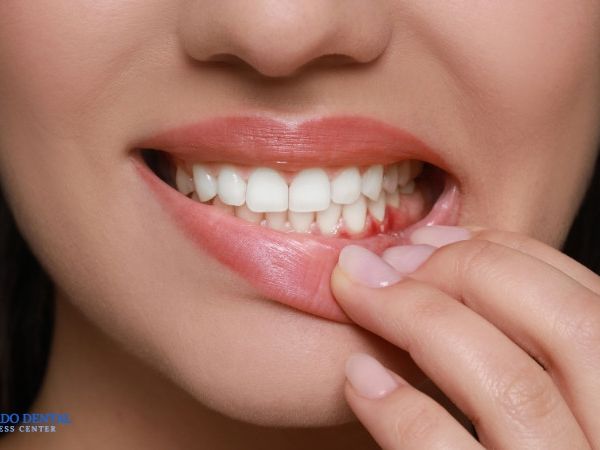advanced-gum-disease-treatment-for-healthier-gums
