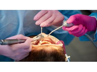 rocklin-comprehensive-dentistry-rocklin-dentist-for-exceptional-care-small-0