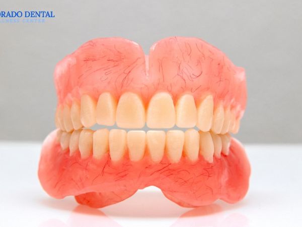 affordable-dentures-for-a-healthy-confident-smile