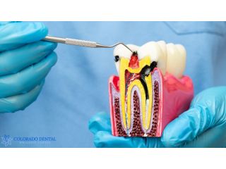 gentle-laser-root-canals-for-faster-comfortable-relief-small-0