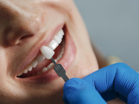 expert-dental-implants-in-livonia-with-natural-results
