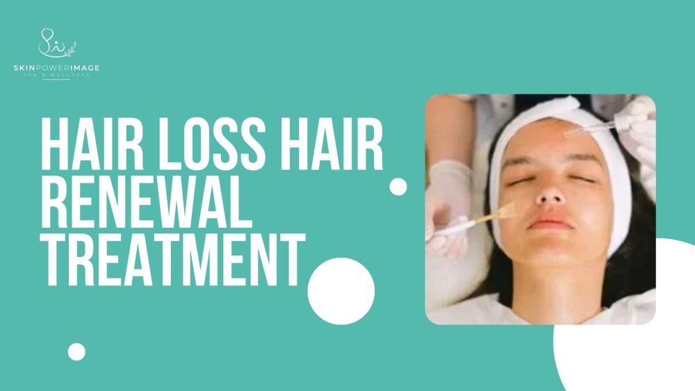 hair-loss-hair-renewal-treatment-big-0