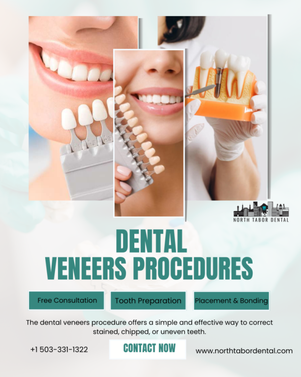 are-denture-veneers-permanent-or-removable-big-0