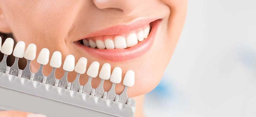 are-denture-veneers-permanent-or-removable-big-2
