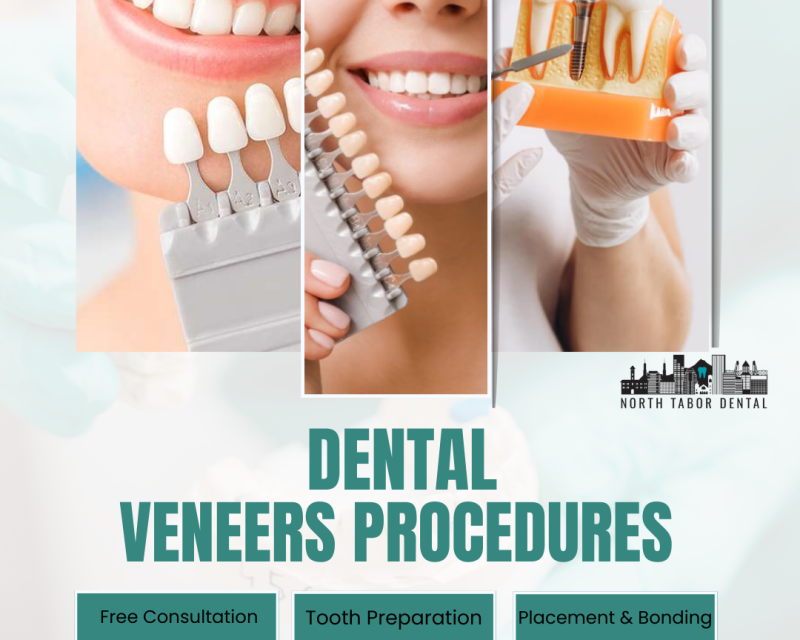 are-denture-veneers-permanent-or-removable