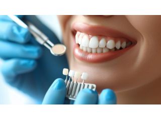 are-denture-veneers-permanent-or-removable-small-1