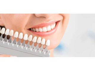 are-denture-veneers-permanent-or-removable-small-2