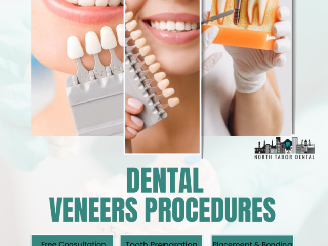 are-denture-veneers-permanent-or-removable