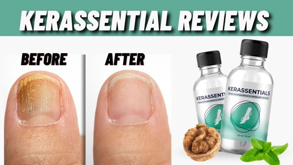 kerassentials-reviews-my-in-depth-analysis-of-this-big-0