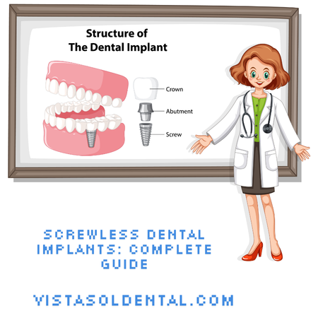 screwless-dental-implants-complete-guide-big-0
