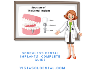 screwless-dental-implants-complete-guide-small-0