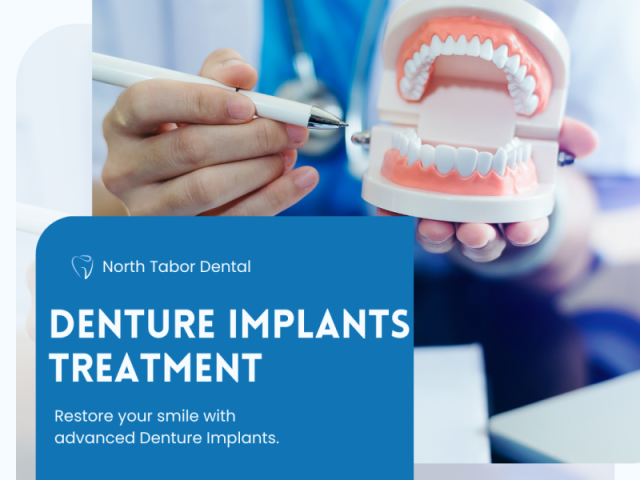 choosing-the-best-denture-implants-treatment-center-near-you