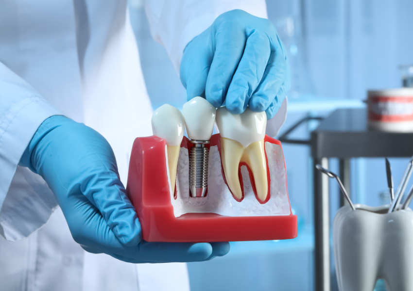 dentures-implants-for-restoration-big-2