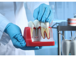 dentures-implants-for-restoration-small-2