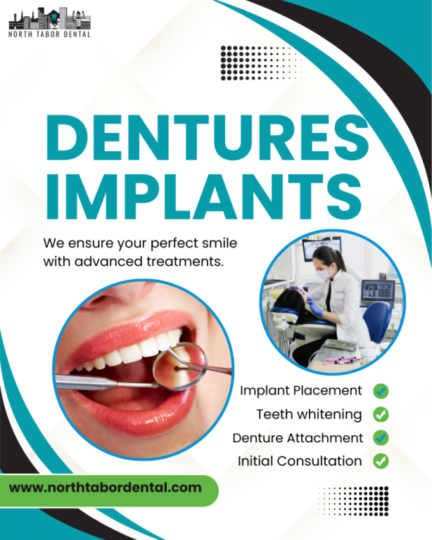 how-long-do-dentures-implants-last-big-0