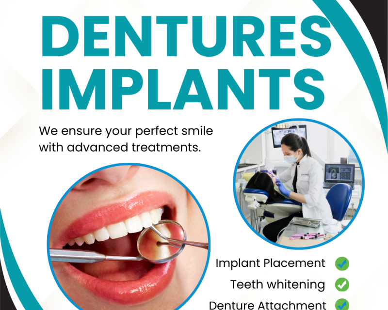 how-long-do-dentures-implants-last