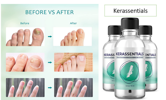 kerassentials-under-review-effective-toenail-fungus-oil-big-0