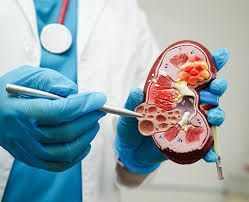 kidney-stone-treatment-laguna-hills-california-big-0