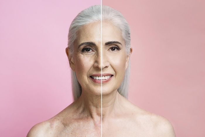 anti-aging-treatment-massachusetts-expert-skin-solutions-big-0