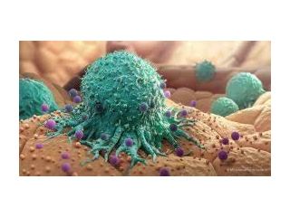 lung-cancer-treatment-in-delhi-ncr-small-0