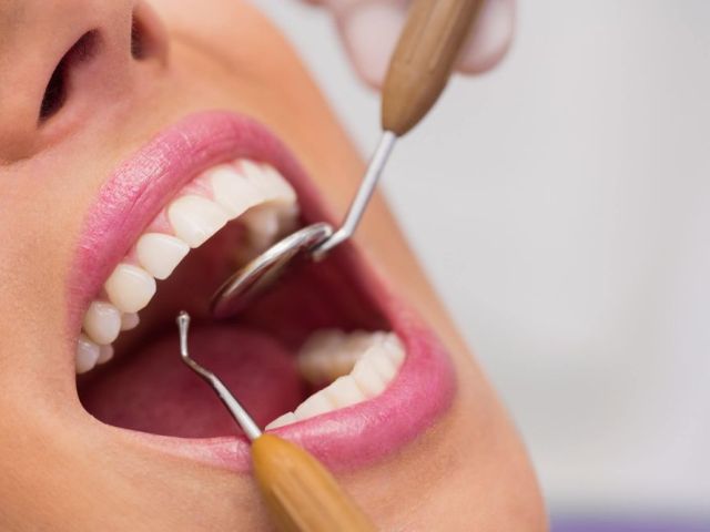 safe-and-professional-wisdom-teeth-removal-in-anchorage-ak