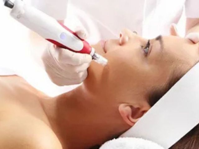 microneedling-treatment-palm-beach-la-vie-spa-gardens