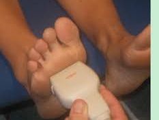 best-doctor-for-flat-feet-south-amboy