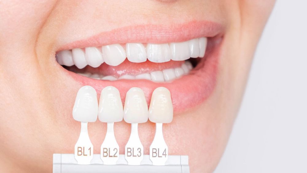 is-dental-veneers-procedure-painful-big-2