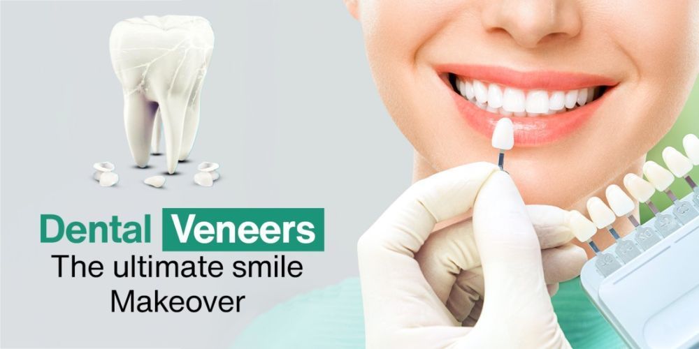 is-dental-veneers-procedure-painful-big-1