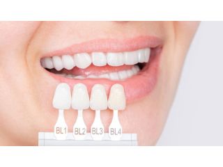 is-dental-veneers-procedure-painful-small-2