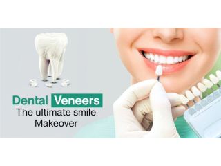is-dental-veneers-procedure-painful-small-1