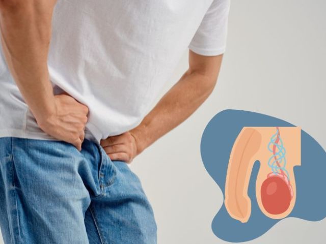 best-varicocele-treatment-safe-effective