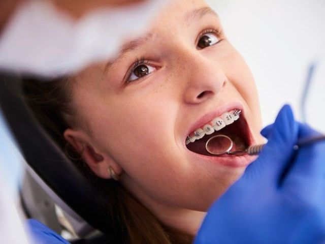 orthodontist-in-gaithersburg-md-braces-invisalign