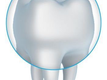 expert-dental-crowns-in-tempe-az
