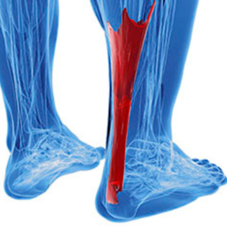 achilles-tendonitis-treatment-houston-trusted-foot-care-big-0