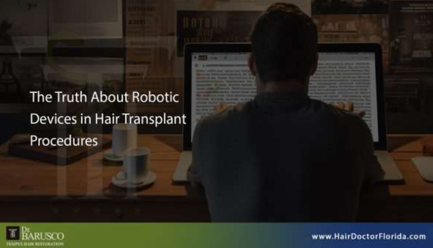 robotic-devices-in-hair-transplant-big-0