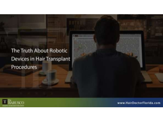 robotic-devices-in-hair-transplant-small-0