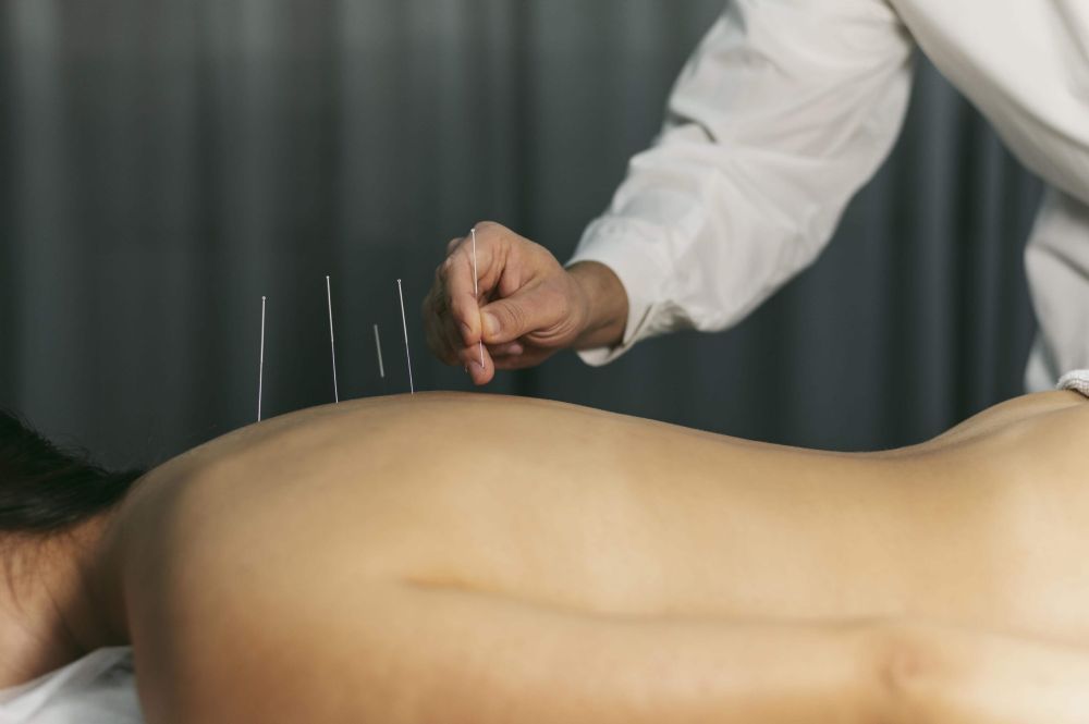 acupuncture-restoring-body-treatment-in-chicago-big-0