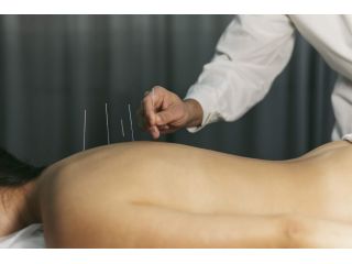 acupuncture-restoring-body-treatment-in-chicago-small-0