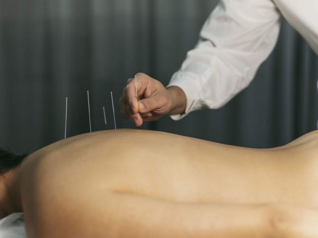 acupuncture-restoring-body-treatment-in-chicago