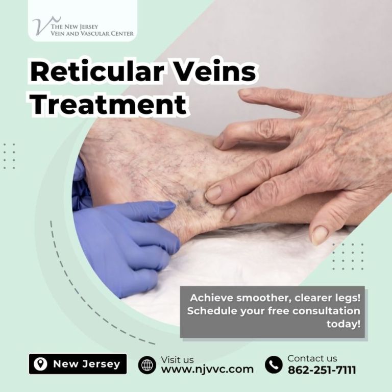 reticular-veins-treatment-in-nj-big-0