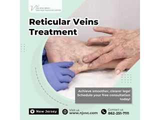 reticular-veins-treatment-in-nj-small-0