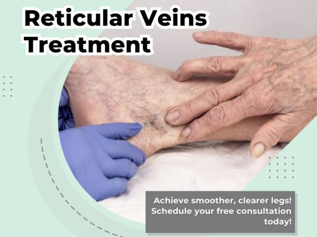 reticular-veins-treatment-in-nj